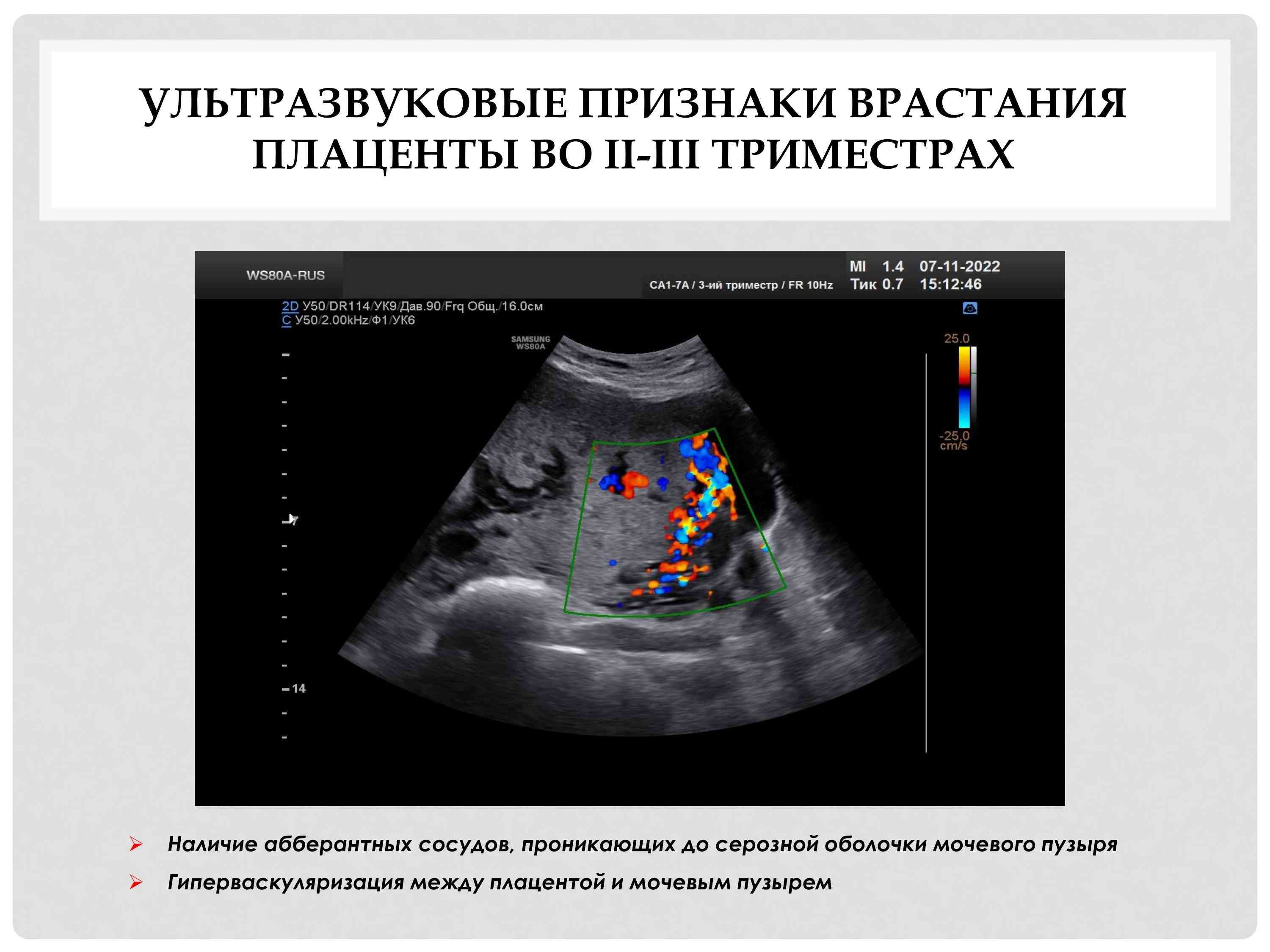 Чувадар 4.jpg